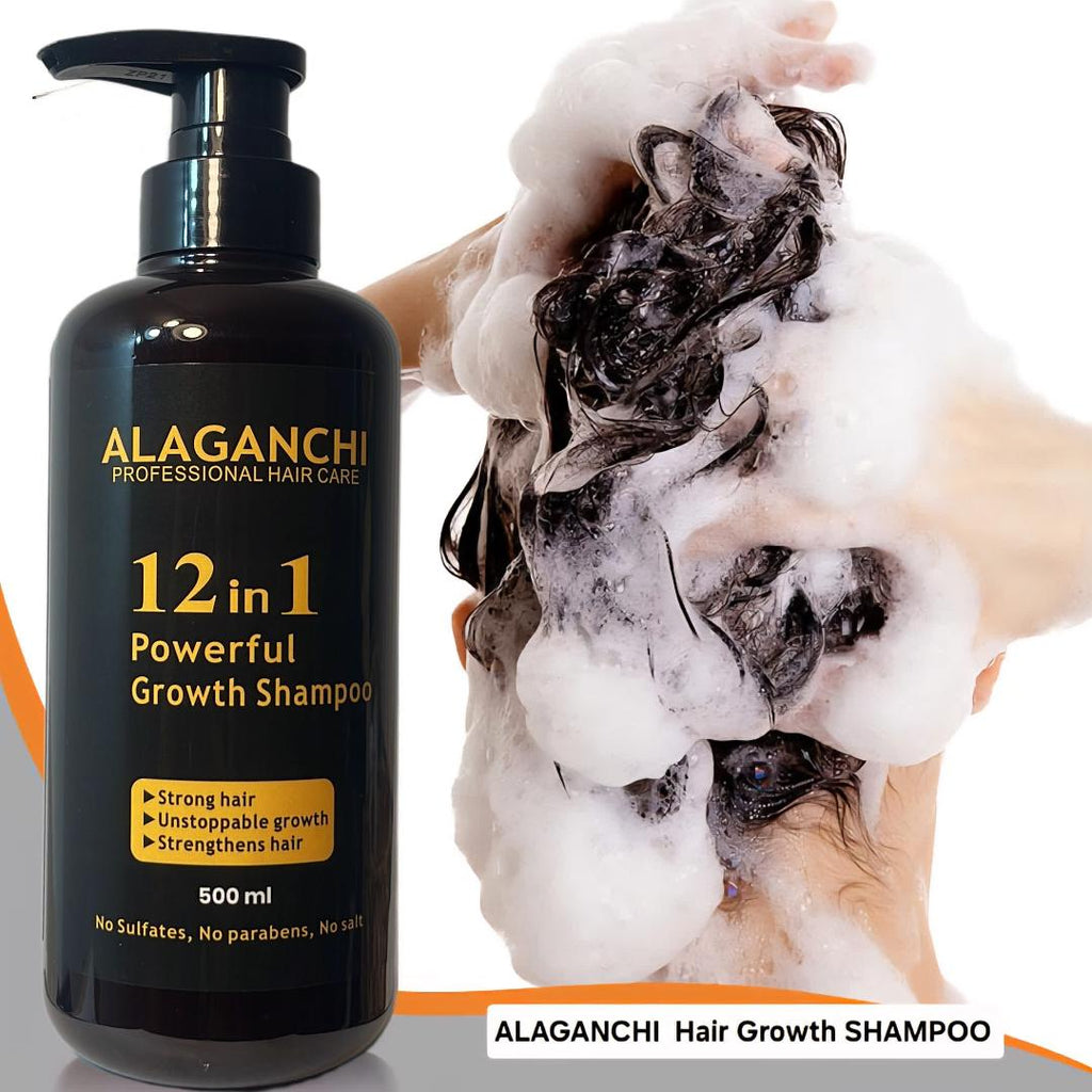 🧴🌿 Alaganchi 12-in-1 Hair Growth Shampoo – Rosemary + Biotin + Argan & Castor Oil + Purple Onion 💆‍♀️✨ (Thicker, Fuller Hair)