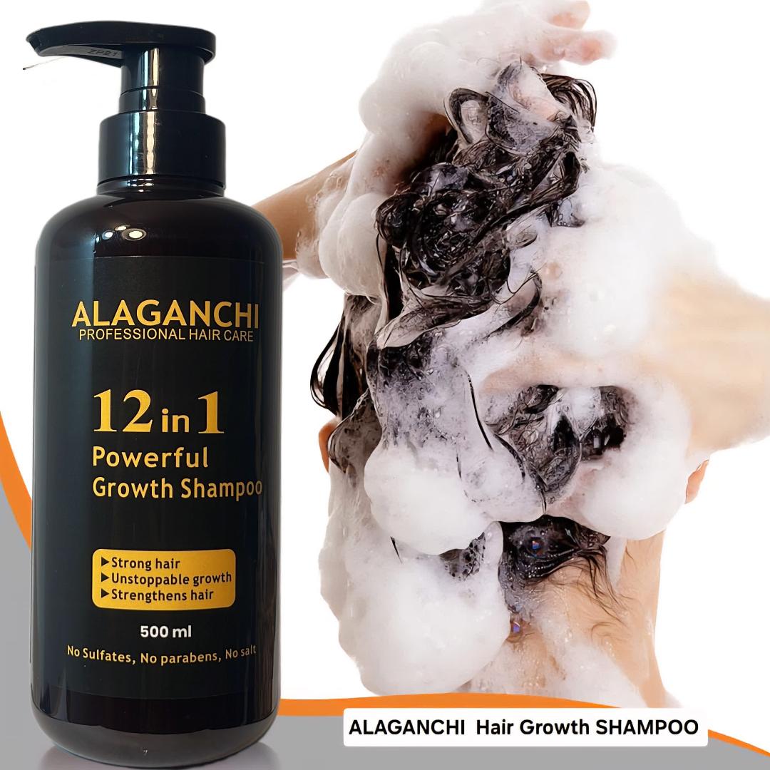 🧴🌿 Alaganchi 12-in-1 Hair Growth Shampoo – Rosemary + Biotin + Argan & Castor Oil + Purple Onion 💆‍♀️✨ (Thicker, Fuller Hair)